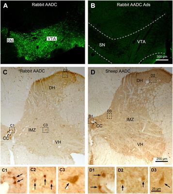 Heterogenic Distribution of Aromatic L-Amino Acid Decarboxylase Neurons in the Rat Spinal Cord